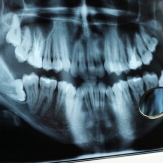 Οδοντιατρείο (Κερατσίνι, Άγ. Στέφανος) | Άγιος Στέφανος